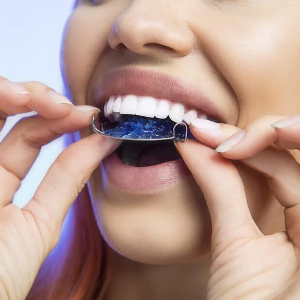 A Guide to Alternatives to Braces in Alamogordo Alternatives to Braces in Alamogordo. MVO. Metal Braces, Lingual Braces, Invisalign, Retainers and more in Alamogordo, NM 88310. 575-437-7900