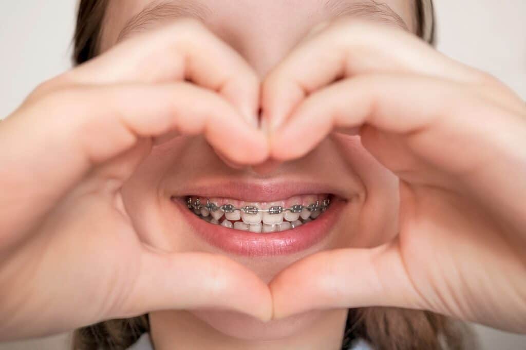 braces for adults alamogordo