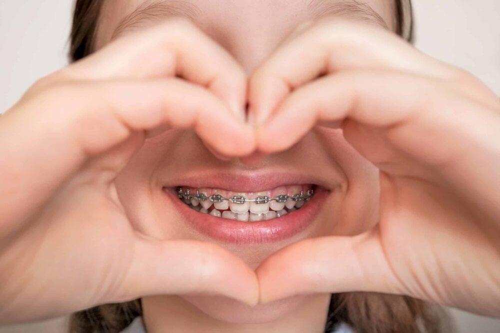 braces for adults alamogordo