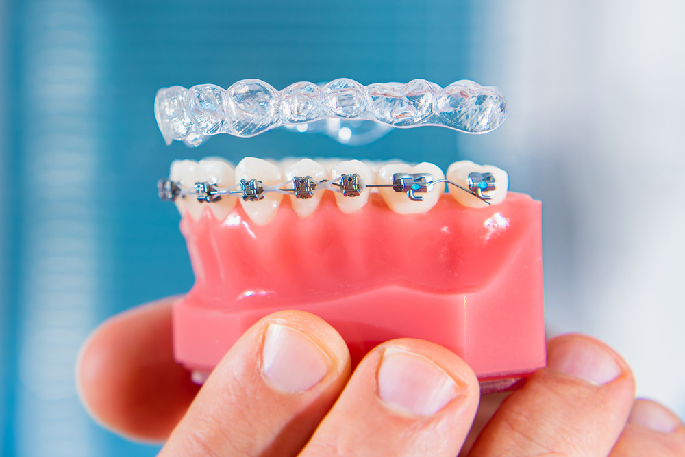 Best Orthodontist in Alamogordo